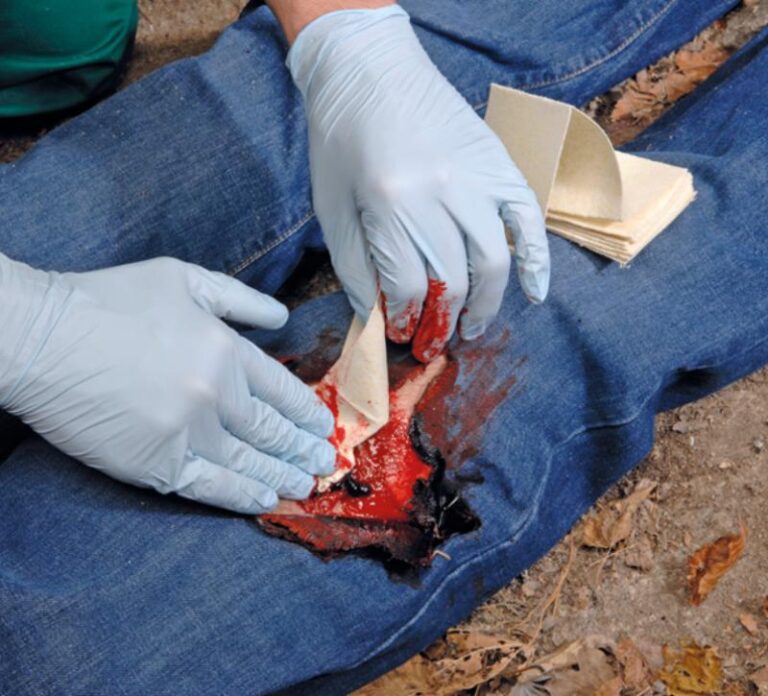Catastrophic Bleeding